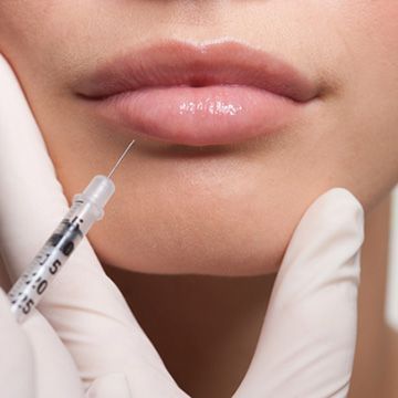 Common Questions About Best Lip Fillers Injections Answered Simply