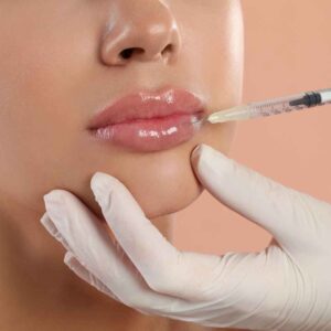 Are the Best Lip Fillers Injections Right for You? Expert Guide