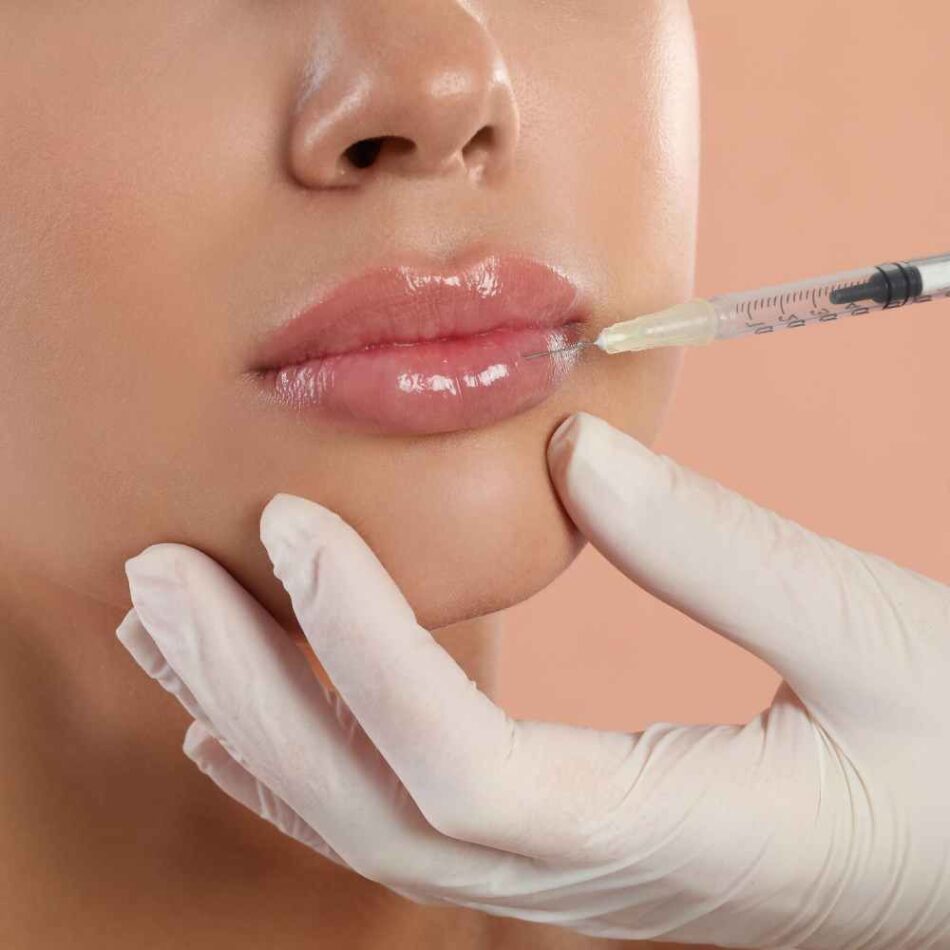 Are the Best Lip Fillers Injections Right for You? Expert Guide