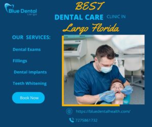 Dental Implants Largo Florida – A Complete 800-Word Blog