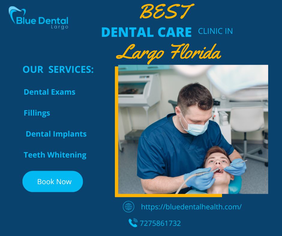 Dental Implants Largo Florida – A Complete 800-Word Blog