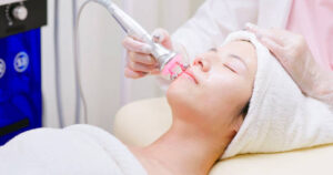 Can Fractional CO2 Laser Treatment Help with Scar Marks?