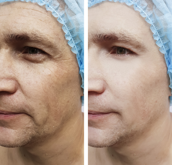 Can PRP Be Combined with Other Cosmetic Treatments Safely?