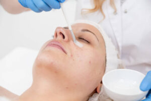 Chemical Peel in Dubai: How Safe Is the Procedure?