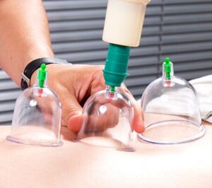 الحجامة لعلاج الربو في الرياض: تأثيرها على نمط الحياة اليومي