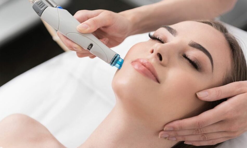 Do HydraFacials Help in Clearing Stubborn Acne?