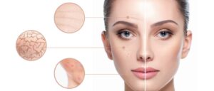 Dubai Facial Scar Treatments: Expert Recommendations
