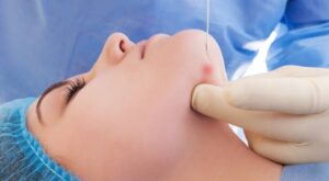 Endolift in Dubai boosts youthful structure for visible renewal