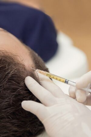 Exosomes Hair Therapy in Dubai: The Ultimate Solution for Hair Loss