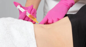 Fat Melting Injection in Dubai: Lipolytic Injection Info