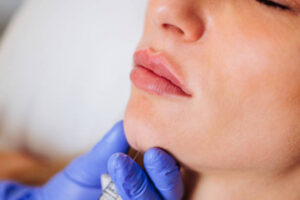 Fillers in Dubai: Correct Facial Symmetry Easily