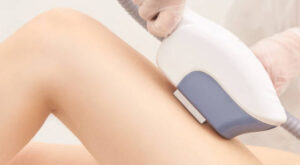 Fractional CO2 in Dubai: Patient Experience and Testimonials