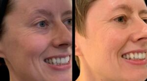 Best Aesthetic Clinic in dubai