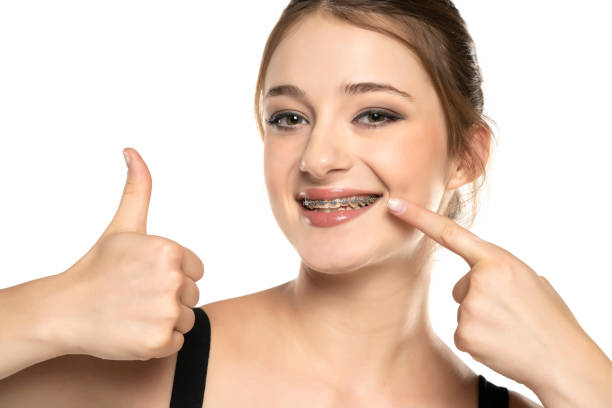 How Dental Braces Build Confidence in Young Adults ?