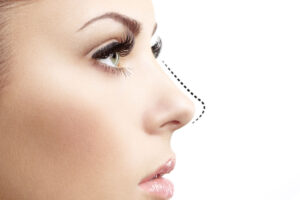 How much does rhinoplasty cost in Dubai, and what factors affect the price?