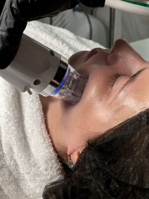 HydraFacial Treatment in Dubai for Oily and Congested Skin: Clearer Skin Ahead