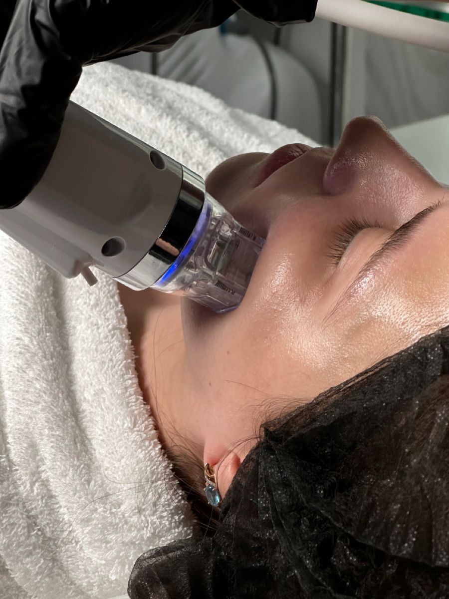 HydraFacial Treatment in Dubai for Oily and Congested Skin: Clearer Skin Ahead