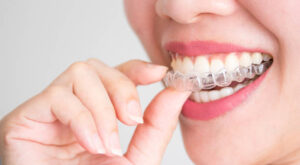 The Pros and Cons of Invisalign Treatment: What You Should Know Before Starting Your Smile Journey