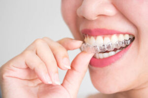 The Pros and Cons of Invisalign Treatment: What You Should Know Before Starting Your Smile Journey
