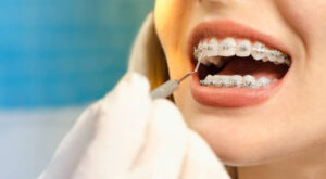 What to Look For When Picking a Top Lafayette CO Orthodontist