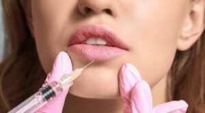 How Long Do Juvederm Fillers Really Last?