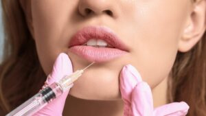 How Long Do Juvederm Fillers Really Last?