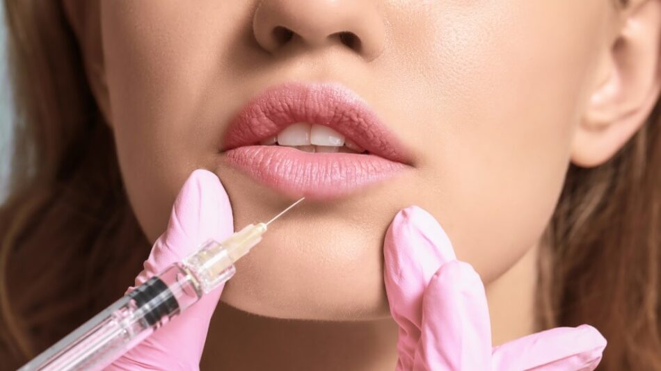 How Long Do Juvederm Fillers Really Last?