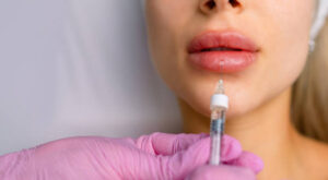 Lip Fillers Injection in Dubai with Proven Safety Record