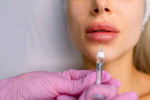 Lip Fillers Injection in Dubai with Proven Safety Record