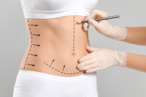 Liposuction in Dubai: The Role of Technology in Enhancing Results