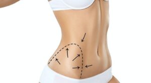 Liposuction in Dubai: Remote Monitoring for Faster Recovery