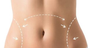 Liposuction in Dubai for Women: Tailored Body Contouring Solutions