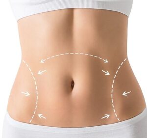 Liposuction in Dubai for Women: Tailored Body Contouring Solutions