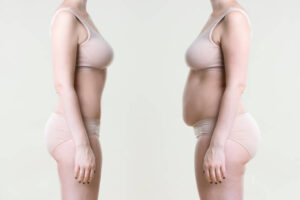 How to Choose the Best Liposuction Method for Your Body Type in Riyadh