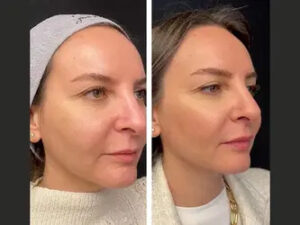 Best Plastic Surgeon in Dubai: Expert Tips for Preparing for Laser Hair Removal