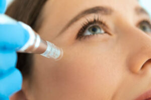 Mesotherapy in Dubai: Advanced Skin Hydration Therapy