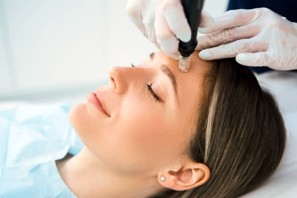 Mesotherapy in Dubai: Hair Treatment vs PRP Explained
