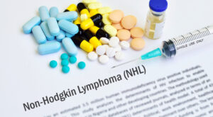 Rising Global Incidence of Non-Hodgkin’s Lymphoma Fuels Strong Growth in Advanced Therapeutics