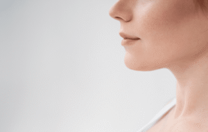 Double Chin Removal Solutions to Boost Confidence and Profile Shape