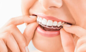 Enhancing Oral Health with Modern Orthodontics in New Canaan, CT