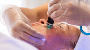 Scar Removal in Dubai: Advanced Laser and Non-Surgical Techniques