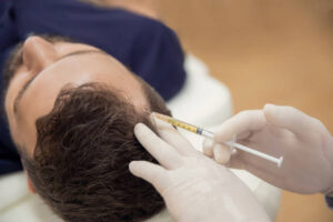 PRP Hair Treatment in Dubai: Better Hair Texture Tips
