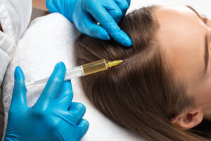 How to Spot the Best PRP Hair Treatment in Dubai for You: 7 Signs and Features