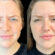 Natural-Looking Botox Results: Tips from the Best Plastic Surgeon in Dubai