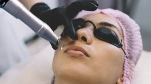 How Pico Laser Treatment Supports Collagen Production for Youthful Skin in Riyadh