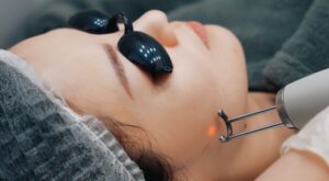 PicoSure Laser Treatment: Bridging Science and Skin Beauty