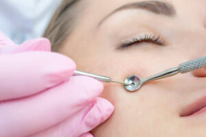 Pimple Treatment in Dubai: Best Options for Clear Skin