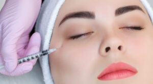 Removing Sculptra Lumps Effective Dubai Options