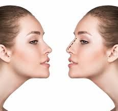 Is Male Rhinoplasty in Dubai Different from Female Procedures?