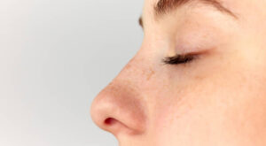 عملية تجميل الأنف: أهم النقاط التي تود معرفتها قبل الإجراء